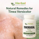 Natural Remedies for Tinea Versicolor.jpg
